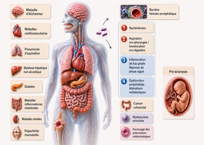 Educational infographic: organs and diseases associated with periodontitis, and the main mechanisms studied (bacteraemia, aspiration and gut translocation, low-grade inflammation, endothelial dysfunction, trained myelopoiesis). Associations and hypotheses, not proven causal links.