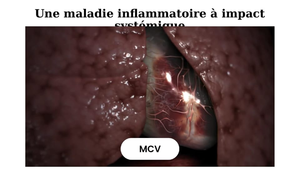 Diapositive du mémoire de DU (2025) du Docteur Hazout, « Parodontite et inflammaging » (Université Paris-Est Créteil). Travail de synthèse ; les pistes présentées sont des hypothèses.