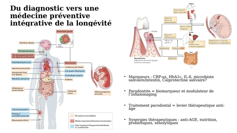 Slide from Dr Hazout's university diploma dissertation (2025): markers studied (high-sensitivity CRP, HbA1c, IL-6, microbiota) and a diagram adapted from Hajishengallis and Chavakis (2021). Research avenues, not routine tests.